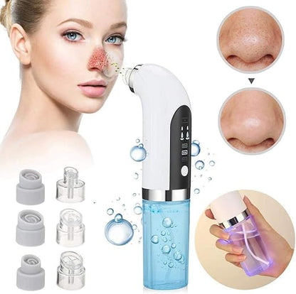 🙂‍↔️Extractor de puntos negros y espinillas🤩Descubre la revolución en cuidado facial con tecnología de dermoabrasión