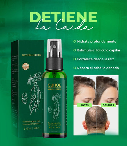 OUHOE Spray Crece Pelo